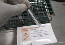 सल्यानमा स्क्रब टाइफसको संक्रमण बढ्दो, दुई दिनमै ५४ जनामा पुष्टि स्क्रब टाइफसको IgM परीक्षणको सकारात्मक नतिजा देखाउने प्रतिनिधिमूलक तस्बिर